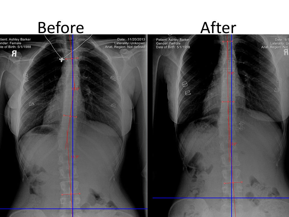 Before After img02